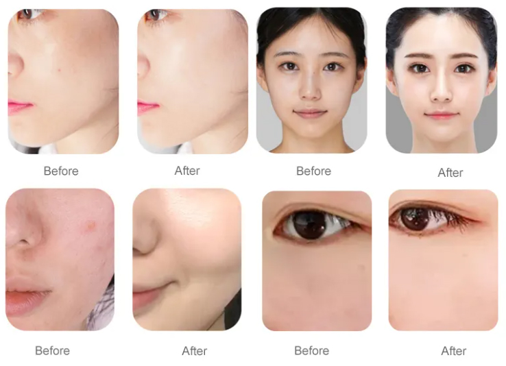 hydraquafacial.sonuc